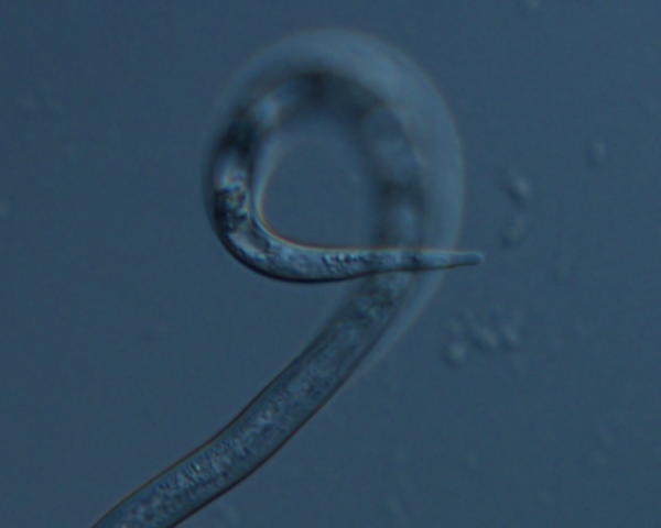 microscopic image of a nematode